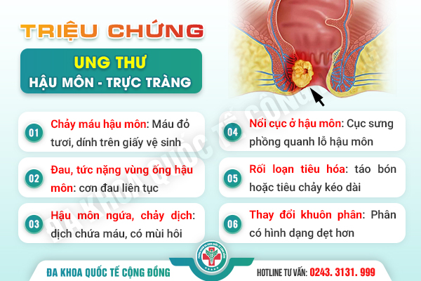 99% người mắc phải sai lầm này khi chữa polyp hậu môn: Tìm hiểu ngay trước khi quá muộn!