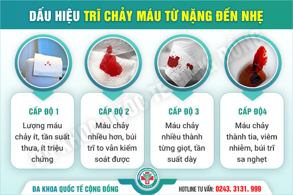 Búi trĩ chảy máu – Cảnh báo mức độ nguy hiểm không thể xem thường!